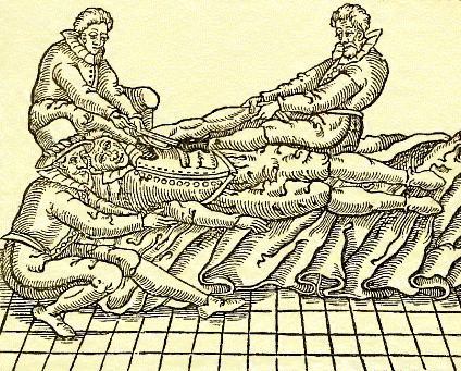 Dislocated Shoulder Fixed With Heel